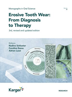 cover image of Erosive Tooth Wear